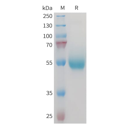 SDS-PAGE - Recombinant Mouse CD70 Protein (Fc Tag) (A317447) - Antibodies.com