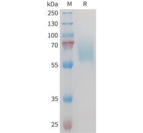 SDS-PAGE - Recombinant Mouse Axl Protein (10×His Tag) (A317448) - Antibodies.com