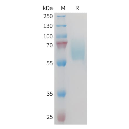 SDS-PAGE - Recombinant Mouse Axl Protein (10×His Tag) (A317448) - Antibodies.com