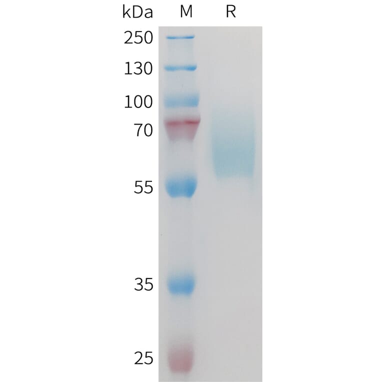 SDS-PAGE - Recombinant Mouse Axl Protein (10×His Tag) (A317448) - Antibodies.com