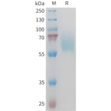 SDS-PAGE - Recombinant Mouse Axl Protein (10×His Tag) (A317448) - Antibodies.com