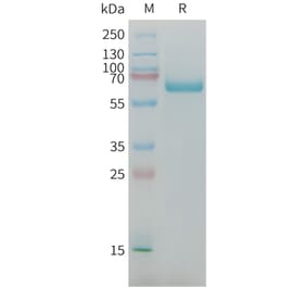 SDS-PAGE - Recombinant Mouse alpha 1 Fetoprotein Protein (6×His Tag) (A317450) - Antibodies.com