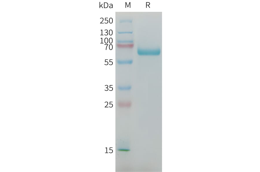 SDS-PAGE - Recombinant Mouse alpha 1 Fetoprotein Protein (6×His Tag) (A317450) - Antibodies.com