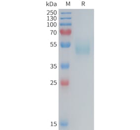 SDS-PAGE - Recombinant Mouse TSLP Protein (Fc Tag) (A317452) - Antibodies.com