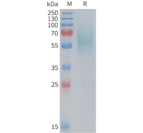 SDS-PAGE - Recombinant Mouse 5T4 Protein (6×His Tag) (A317453) - Antibodies.com
