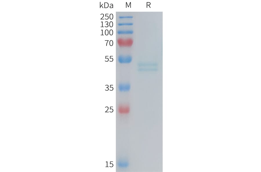 SDS-PAGE - Recombinant Mouse IL-11RA Protein (6×His Tag) (A317454) - Antibodies.com