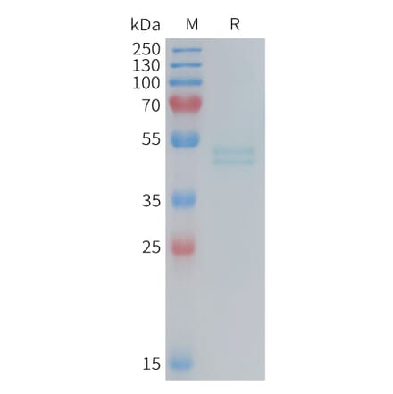 SDS-PAGE - Recombinant Mouse IL-11RA Protein (6×His Tag) (A317454) - Antibodies.com