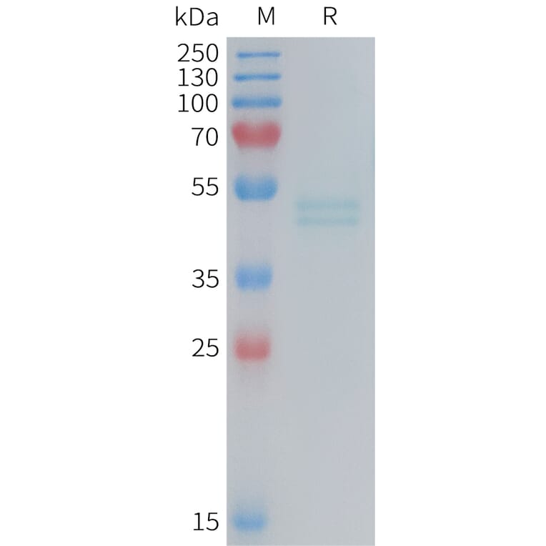 SDS-PAGE - Recombinant Mouse IL-11RA Protein (6×His Tag) (A317454) - Antibodies.com