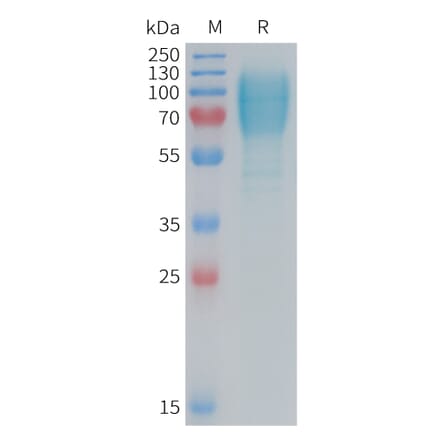 SDS-PAGE - Recombinant Mouse GC-C Protein (6×His Tag) (A317455) - Antibodies.com