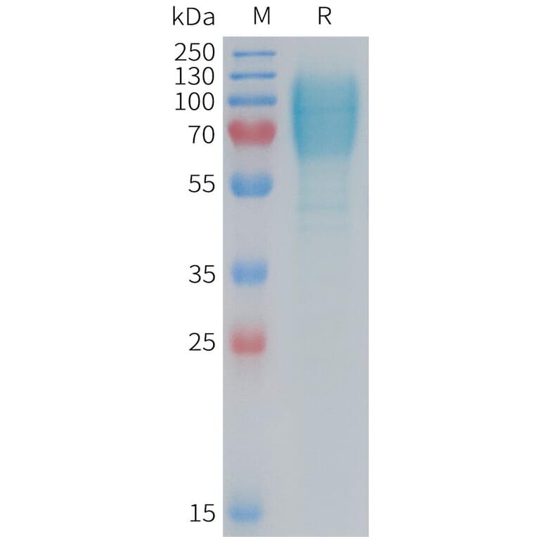 SDS-PAGE - Recombinant Mouse GC-C Protein (6×His Tag) (A317455) - Antibodies.com