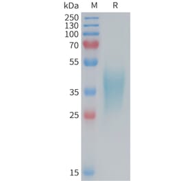 SDS-PAGE - Recombinant Mouse TNF Receptor II Protein (6×His Tag) (A317456) - Antibodies.com