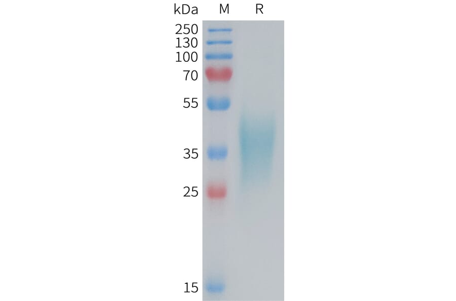 SDS-PAGE - Recombinant Mouse TNF Receptor II Protein (6×His Tag) (A317456) - Antibodies.com