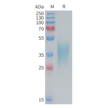 SDS-PAGE - Recombinant Mouse TNF Receptor II Protein (6×His Tag) (A317456) - Antibodies.com