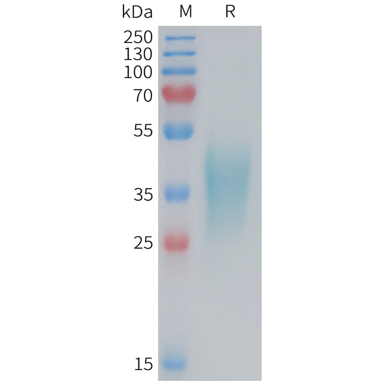 SDS-PAGE - Recombinant Mouse TNF Receptor II Protein (6×His Tag) (A317456) - Antibodies.com