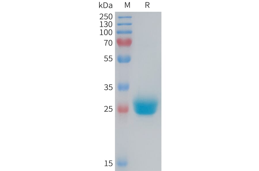 SDS-PAGE - Recombinant Mouse Coxsackie Adenovirus Receptor/hCAR Protein (6×His Tag) (A317457) - Antibodies.com