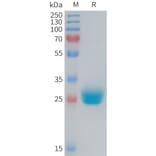 SDS-PAGE - Recombinant Mouse Coxsackie Adenovirus Receptor/hCAR Protein (6×His Tag) (A317457) - Antibodies.com