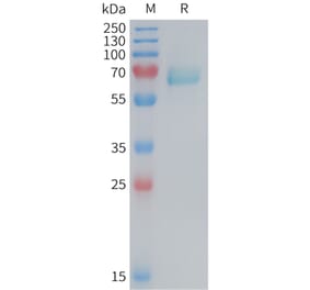 SDS-PAGE - Recombinant Mouse Eph Receptor A2 Protein (6×His Tag) (A317458) - Antibodies.com