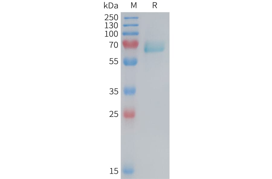 SDS-PAGE - Recombinant Mouse Eph Receptor A2 Protein (6×His Tag) (A317458) - Antibodies.com