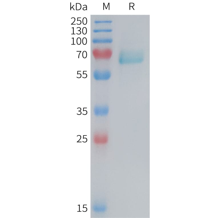 SDS-PAGE - Recombinant Mouse Eph Receptor A2 Protein (6×His Tag) (A317458) - Antibodies.com