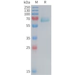 SDS-PAGE - Recombinant Mouse Eph Receptor A2 Protein (6×His Tag) (A317458) - Antibodies.com