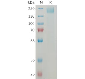 SDS-PAGE - Recombinant Mouse Sez6 Protein (6×His Tag) (A317459) - Antibodies.com
