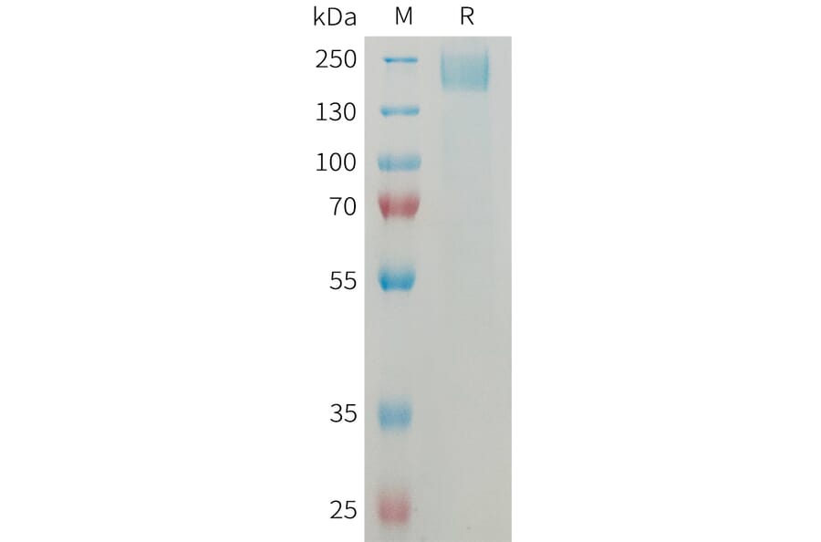 SDS-PAGE - Recombinant Mouse Sez6 Protein (6×His Tag) (A317459) - Antibodies.com