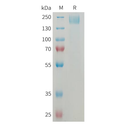 SDS-PAGE - Recombinant Mouse Sez6 Protein (6×His Tag) (A317459) - Antibodies.com