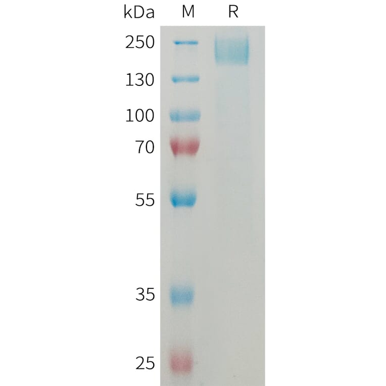 SDS-PAGE - Recombinant Mouse Sez6 Protein (6×His Tag) (A317459) - Antibodies.com