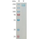 SDS-PAGE - Recombinant Mouse Sez6 Protein (6×His Tag) (A317459) - Antibodies.com