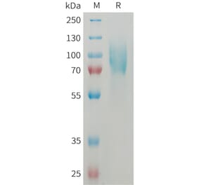 SDS-PAGE - Recombinant Mouse ICAM1 Protein (6×His Tag) (A317460) - Antibodies.com
