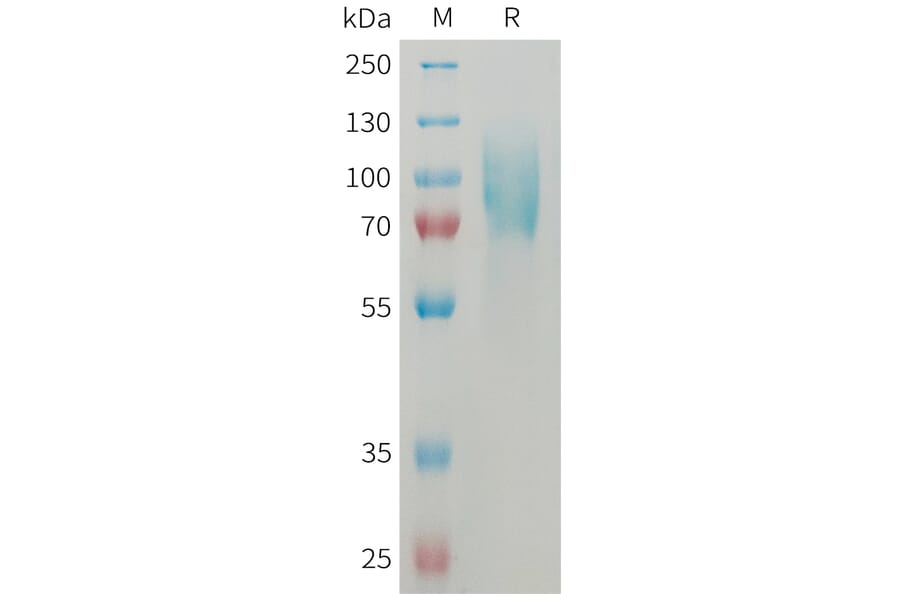 SDS-PAGE - Recombinant Mouse ICAM1 Protein (6×His Tag) (A317460) - Antibodies.com