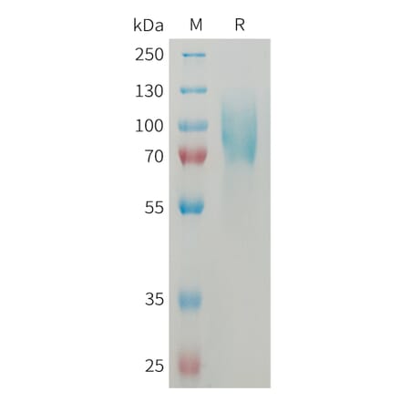 SDS-PAGE - Recombinant Mouse ICAM1 Protein (6×His Tag) (A317460) - Antibodies.com