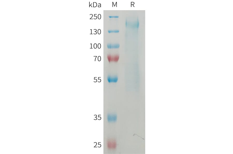 SDS-PAGE - Recombinant Mouse CD45 Protein (6×His Tag) (A317461) - Antibodies.com