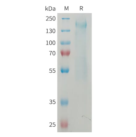 SDS-PAGE - Recombinant Mouse CD45 Protein (6×His Tag) (A317461) - Antibodies.com