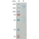 SDS-PAGE - Recombinant Mouse CD45 Protein (6×His Tag) (A317461) - Antibodies.com