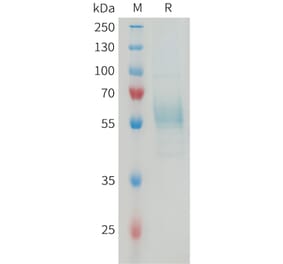 SDS-PAGE - Recombinant Mouse TREM2 Protein (Fc Tag) (A317462) - Antibodies.com