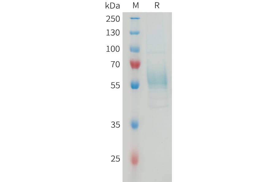 SDS-PAGE - Recombinant Mouse TREM2 Protein (Fc Tag) (A317462) - Antibodies.com