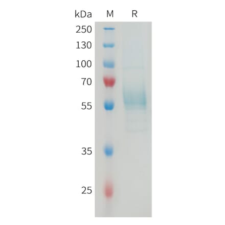 SDS-PAGE - Recombinant Mouse TREM2 Protein (Fc Tag) (A317462) - Antibodies.com