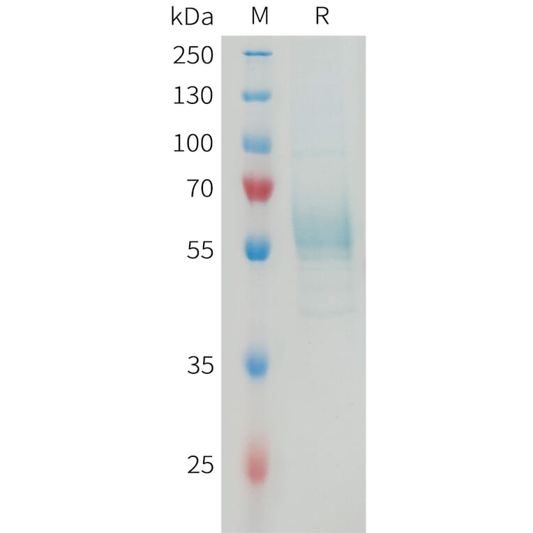 SDS-PAGE - Recombinant Mouse TREM2 Protein (Fc Tag) (A317462) - Antibodies.com