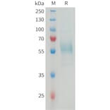 SDS-PAGE - Recombinant Mouse TREM2 Protein (Fc Tag) (A317462) - Antibodies.com