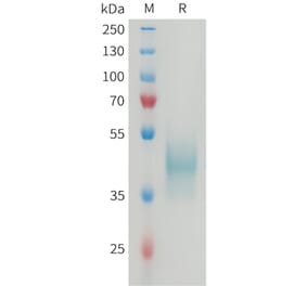 SDS-PAGE - Recombinant Mouse CD24 Protein (Fc Tag) (A317463) - Antibodies.com