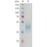 SDS-PAGE - Recombinant Mouse CD24 Protein (Fc Tag) (A317463) - Antibodies.com