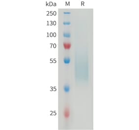 SDS-PAGE - Recombinant Mouse B7H4 Protein (6×His Tag) (A317464) - Antibodies.com