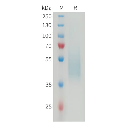 SDS-PAGE - Recombinant Mouse B7H4 Protein (6×His Tag) (A317464) - Antibodies.com