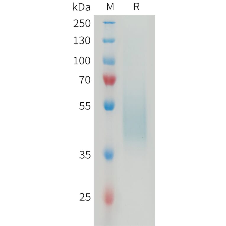 SDS-PAGE - Recombinant Mouse B7H4 Protein (6×His Tag) (A317464) - Antibodies.com