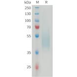 SDS-PAGE - Recombinant Mouse B7H4 Protein (6×His Tag) (A317464) - Antibodies.com