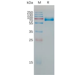 SDS-PAGE - Recombinant Mouse PD-L1 Protein (Fc Tag) (A317465) - Antibodies.com