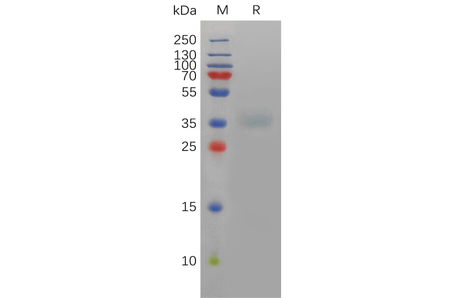 SDS-PAGE - Recombinant Mouse Asialoglycoprotein Receptor 1/HL-1 Protein (6×His Tag) (A317466) - Antibodies.com