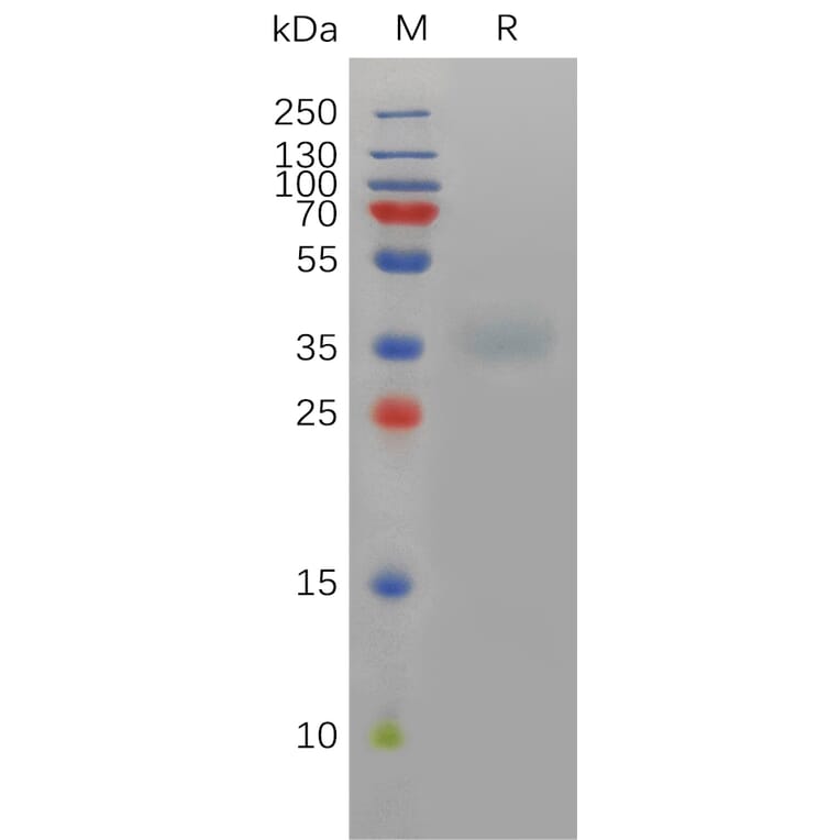 SDS-PAGE - Recombinant Mouse Asialoglycoprotein Receptor 1/HL-1 Protein (6×His Tag) (A317466) - Antibodies.com