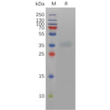 SDS-PAGE - Recombinant Mouse Asialoglycoprotein Receptor 1/HL-1 Protein (6×His Tag) (A317466) - Antibodies.com